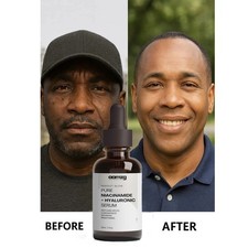 Skin Bleaching Serum for Dark